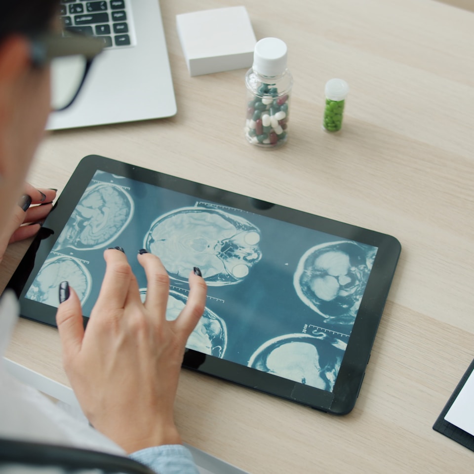 Doctor reviewing patient MRI scans on a tablet medical software interface